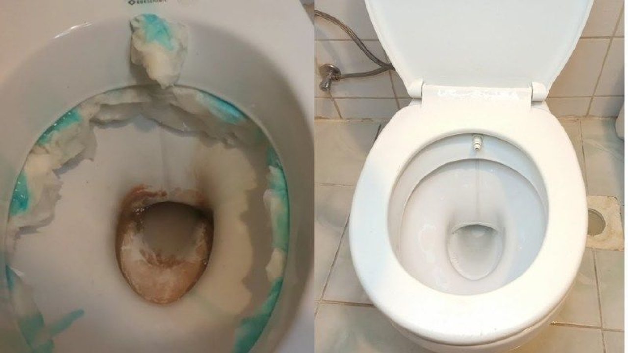 Klozeti en iyi ne temizler? Sararan klozeti kar beyaz yapan müthiş teknik! Ovalamaya bile gerek yok...