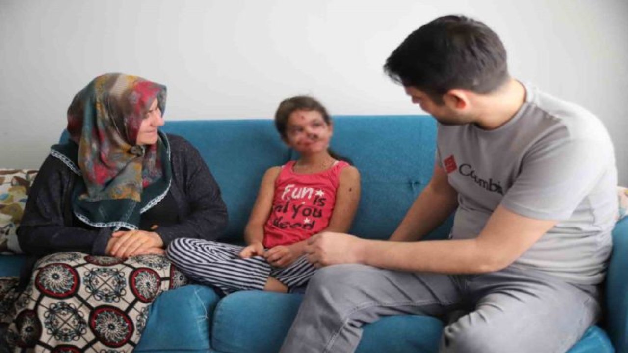 Gaziantep'te cilt kanseri ile savaşan küçük Cemile'nin FERYADI: 'Güneş neden bana düşman oldu'