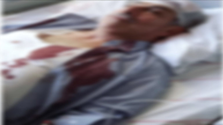 Gaziantep'te esnafı üzen haber! Eski Başkan Küsbeoğlu kaza geçirdi