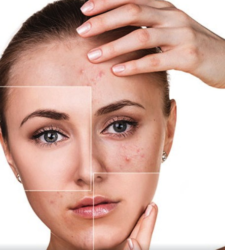 Glikolik Asit Nedir, Ne İşe Yarar?