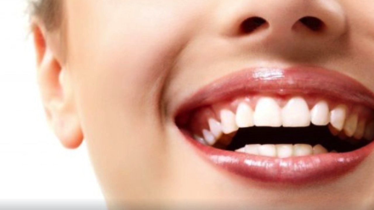 Estetik ve Beyaz Gülüşlere Nasıl Sahip Olabiliriz?