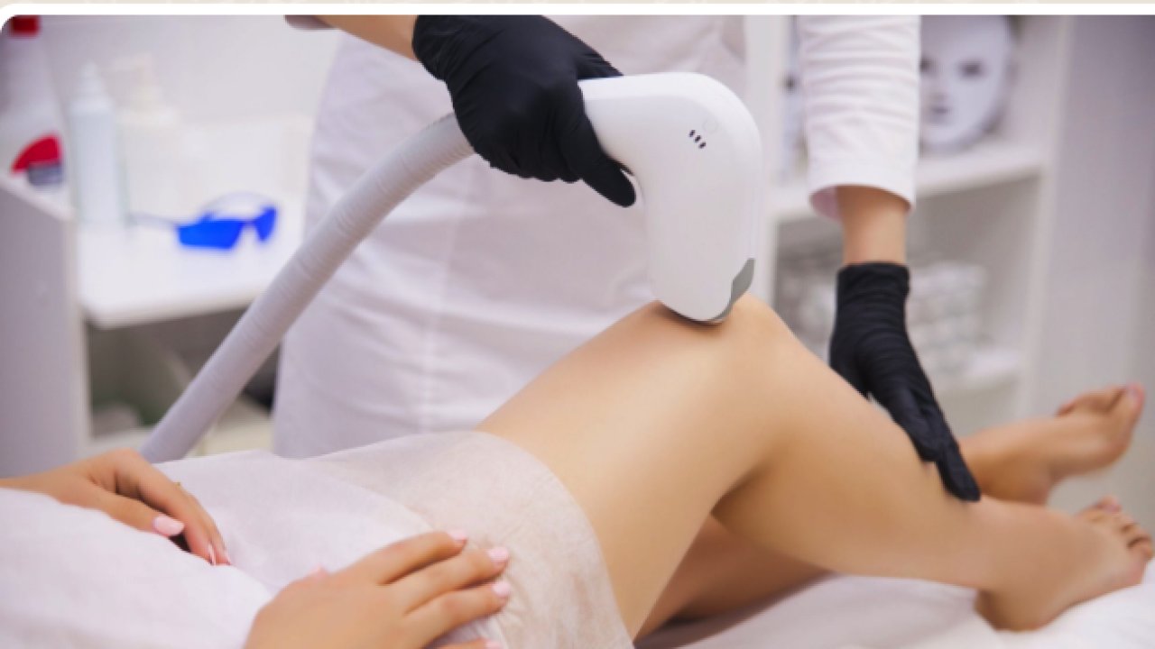 Lazer Epilasyon Nedir?