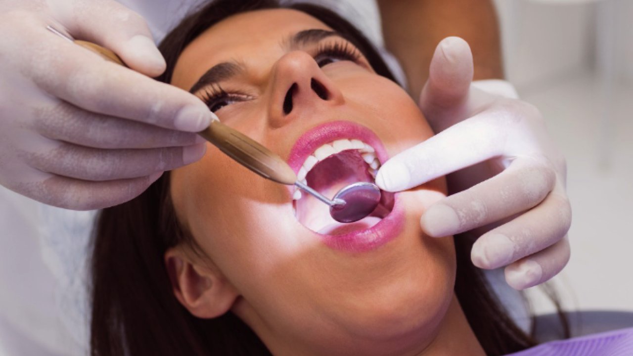 Estetik ve Doğal Gülüşler İçin Mükemmel Bir Seçenek