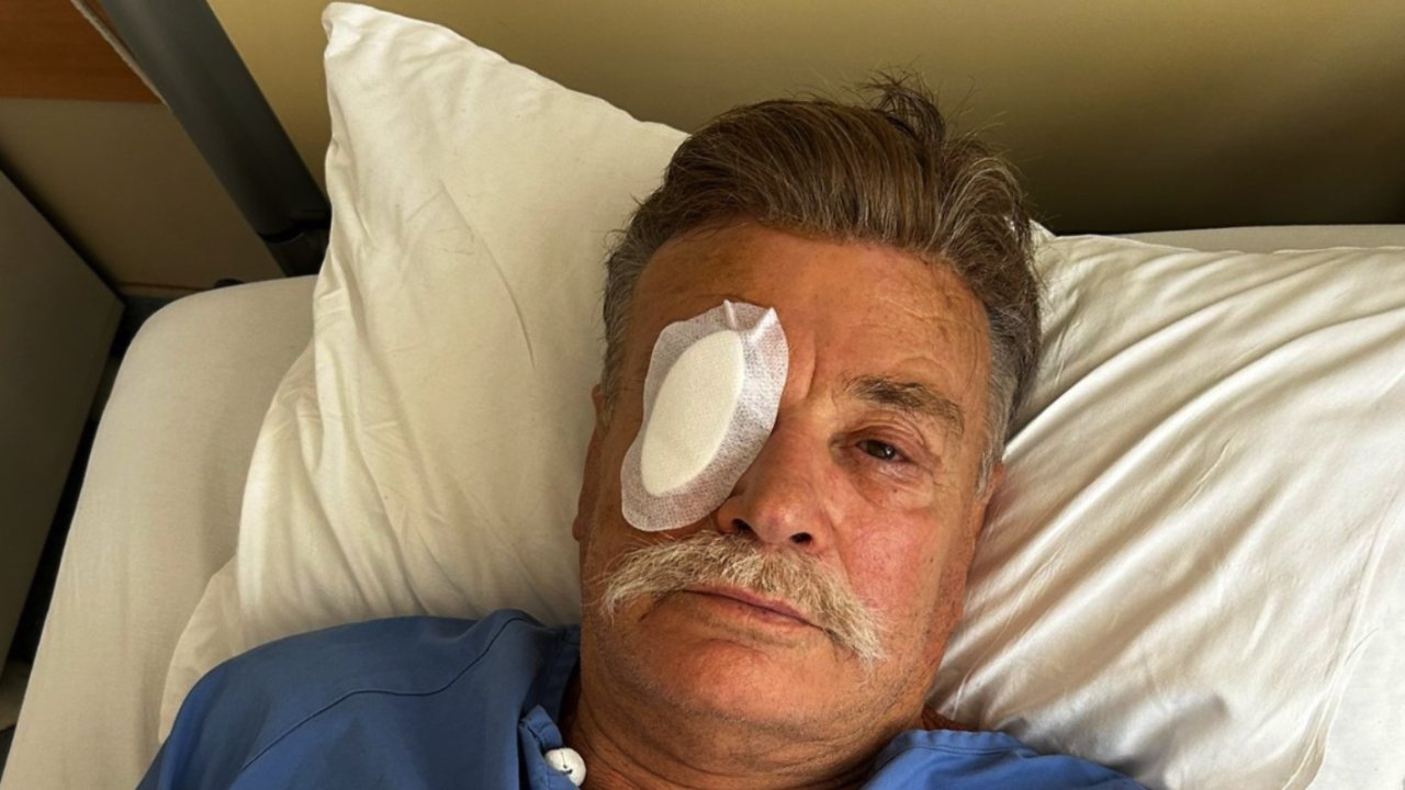 Nuri Alço Kornea Nakli Oldu