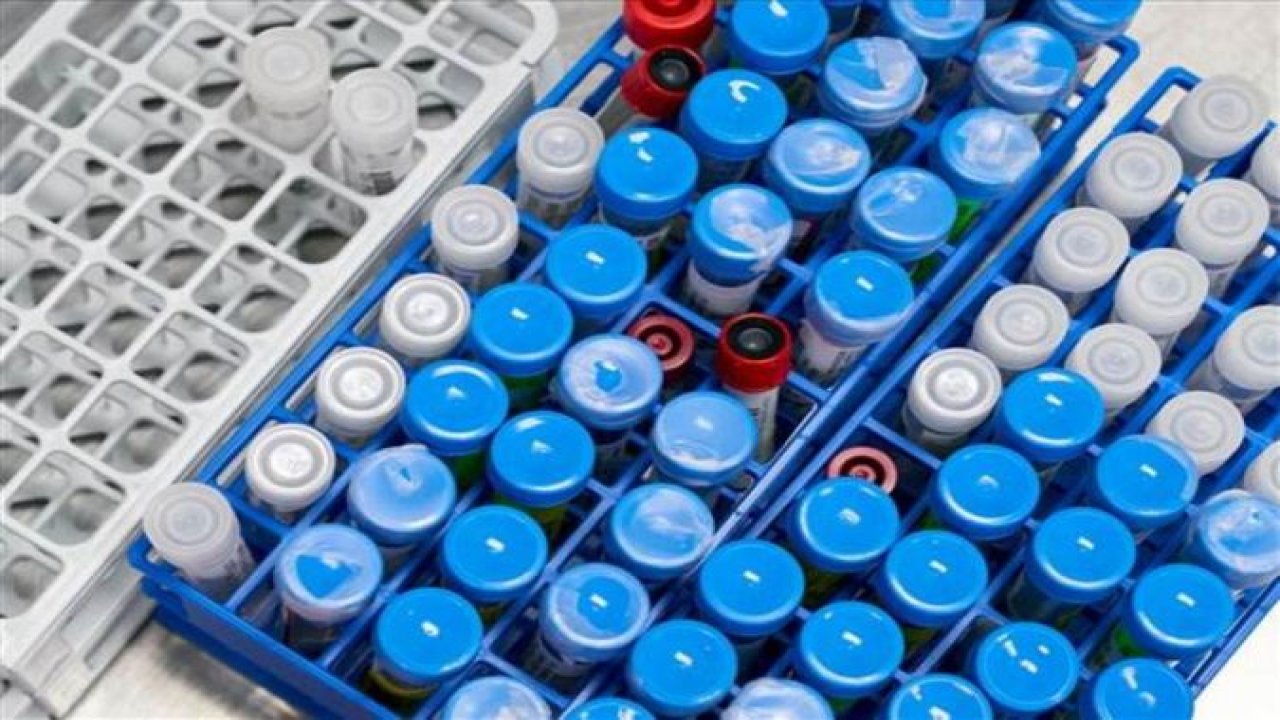 Son Dakika...Gaziantep'te Koronada Son Durum...Koronavirüs tablosu günlük vaka sayıları yayınlandı.. İstanbul, Ankara,Gaziantep ve tüm bölgelerimizin vaka sayısı.. Corona virüs Türkiye tablosu