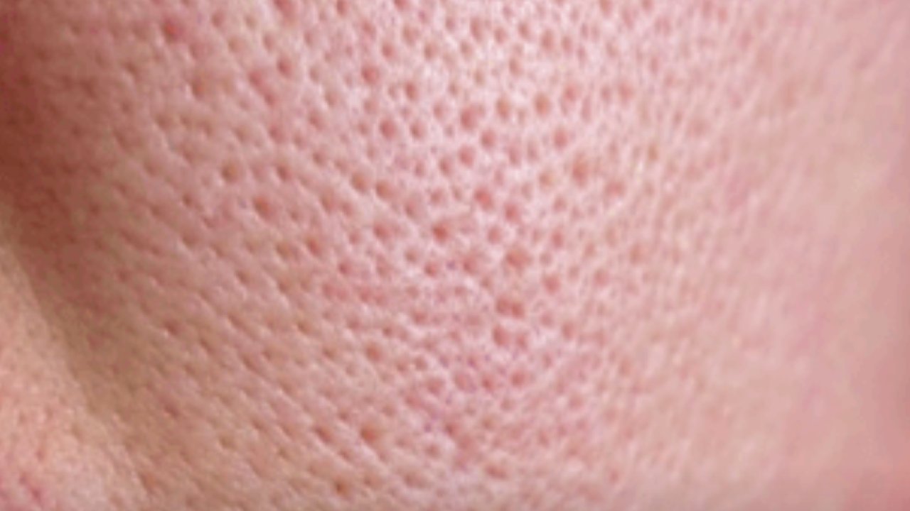 En Popüler 10 Cilt Hastalığı ve Tedavi Yöntemleri