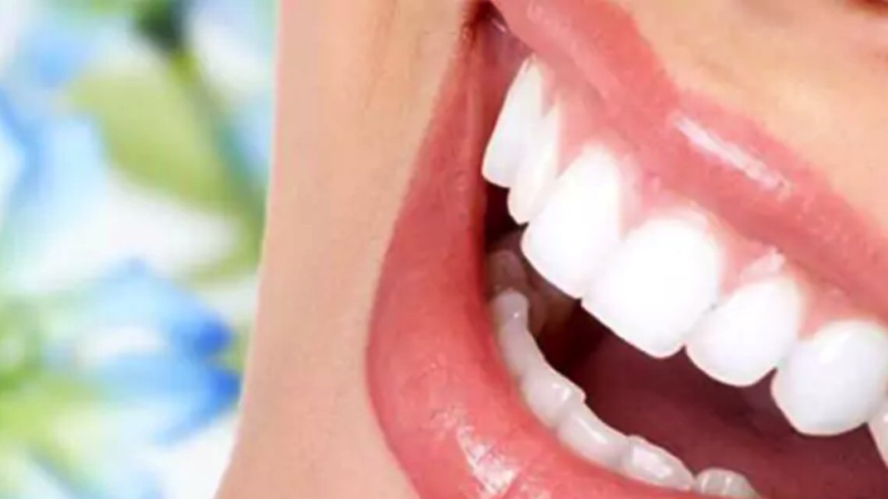 Porselen kaplama diş fiyatları neye göre belirlenir?