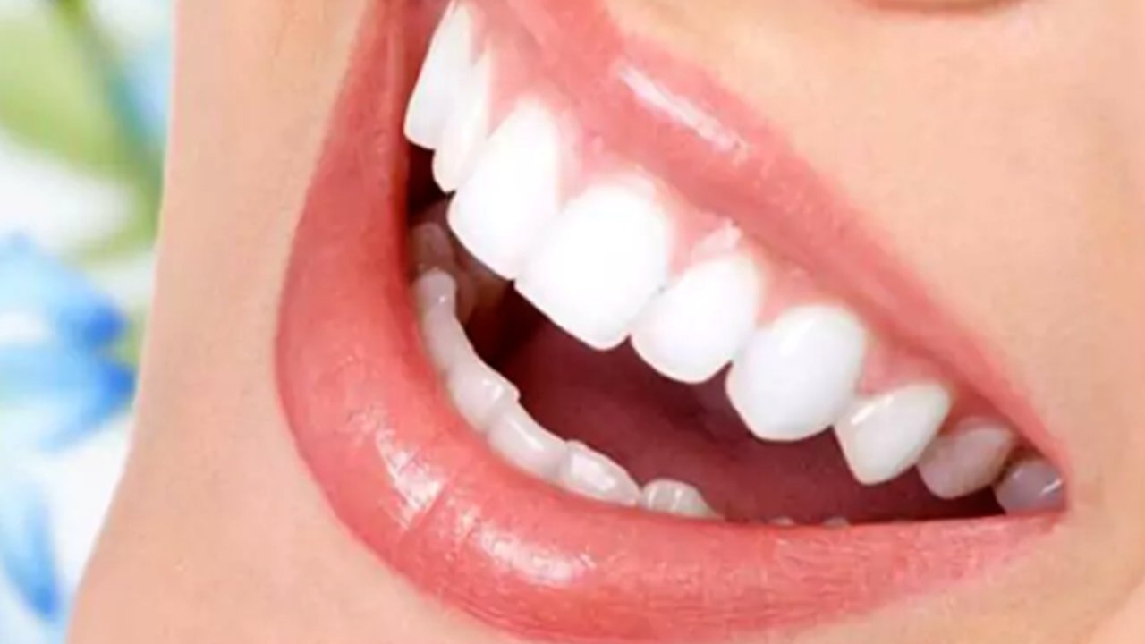 Porselen kaplama diş fiyatları neye göre belirlenir?