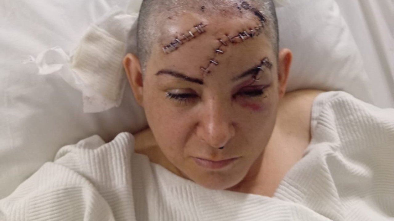 Eşinin satırla ağır yaraladığı kadın tedavi gördüğü Gaziantep'te dehşet anlarını anlattı...