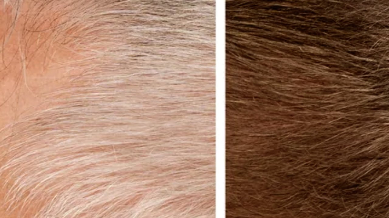 GR-7'yi Tanıyalım: Beyaz Saçlara Doğal Çözüm