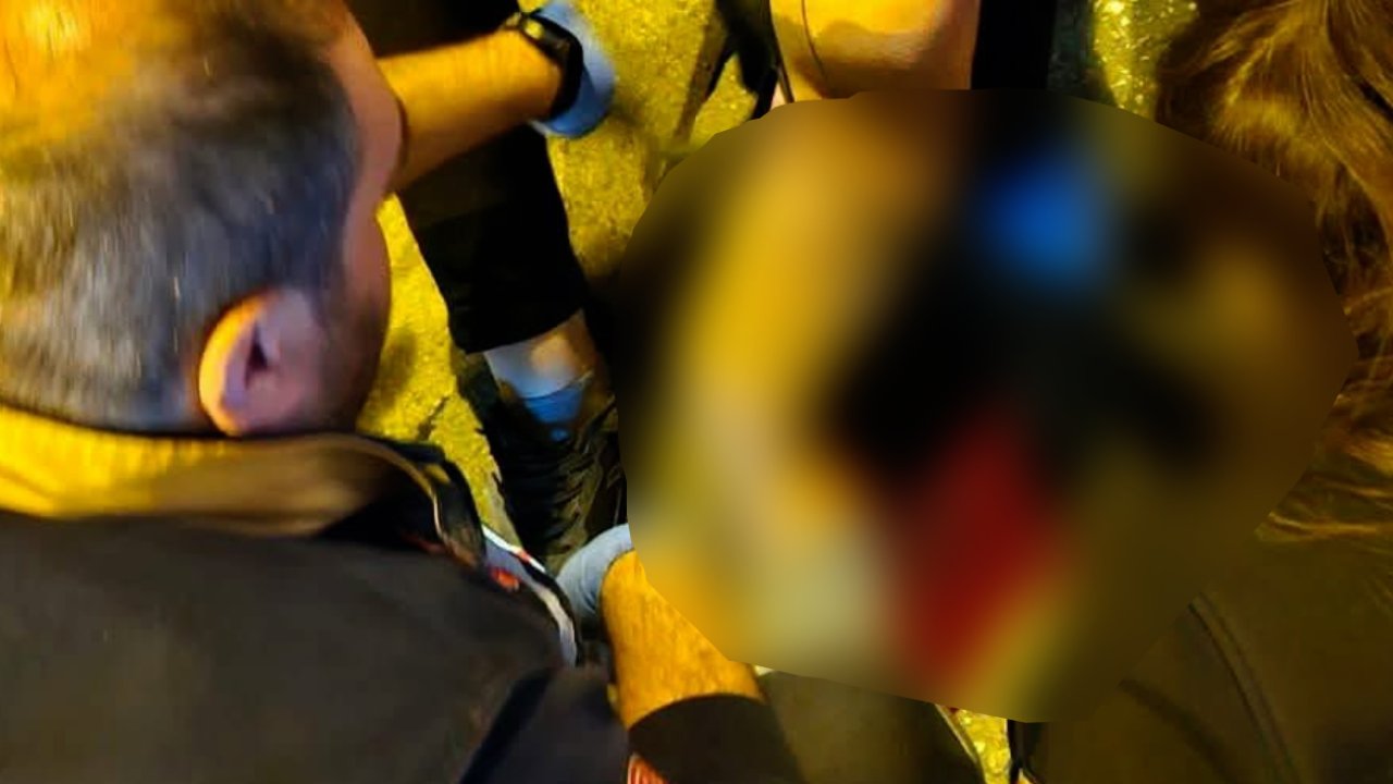 Nizip'te Sokak Köpeği Dehşeti! Köpeklerden Kaçan Gence Otomobil Çarptı