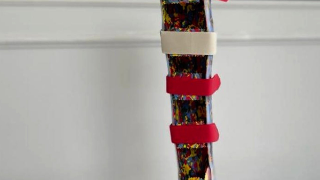 Kafo Ortezi Hangi Durumlarda Kullanılmalıdır?