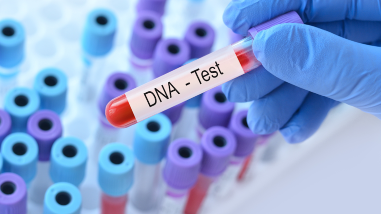 Eğlencesine DNA Testi Yaptıran Kadın, Kocasıyla Kardeş Çıktı