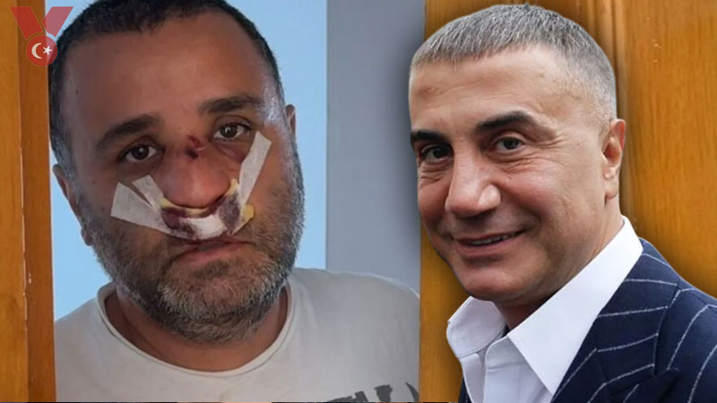 Sedat Peker’den Marmaray’daki Saldırı Mağduruna 2,5 Milyon TL’lik Destek: "İlahi Adalet Yerini Bulur"