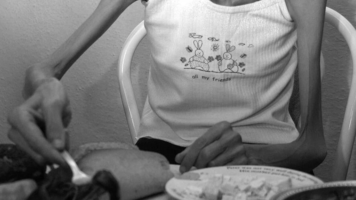 Anoreksiya Nervoza Nedir? Belirtileri, Nedenleri ve Tedavi Süreci