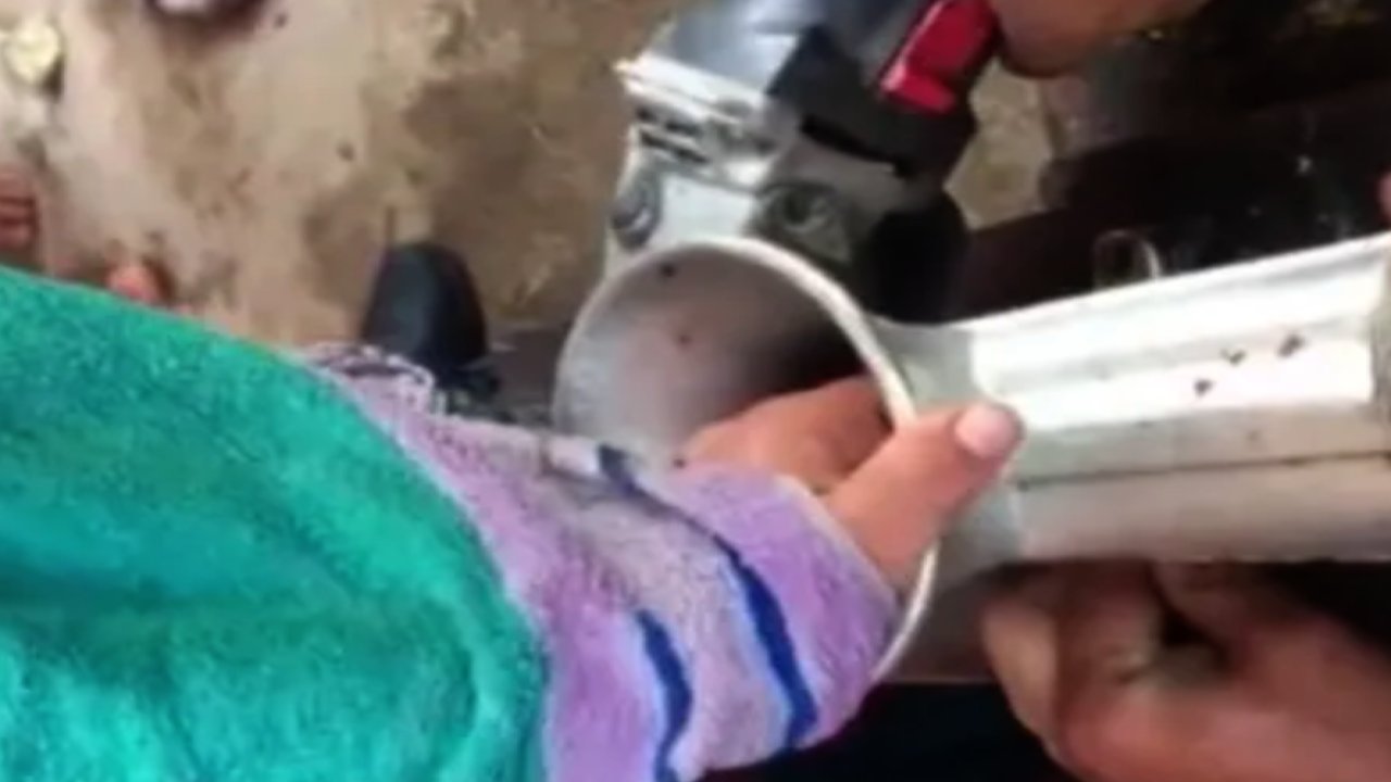 Gaziantep'te 14 yaşındaki çocuğun eli koptu.