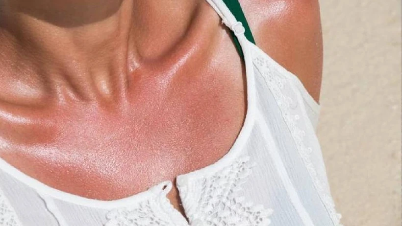 Güneşsiz Bronzluk Mümkün Mü? Gaziantepli Kadınların Yeni Güzellik Sırrı Ev Yapımı Yağlarda Gizli