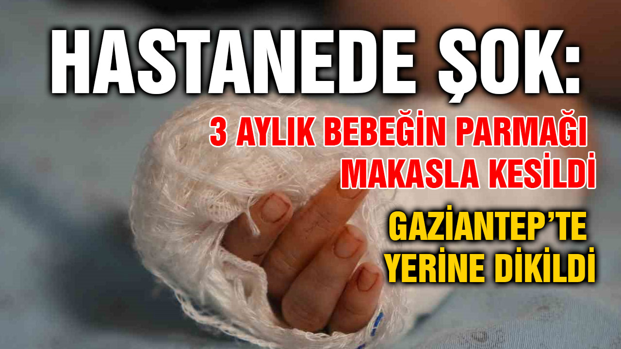 Hastanede Şok: 3 Aylık Bebeğin Parmağı Makasla Kesildi