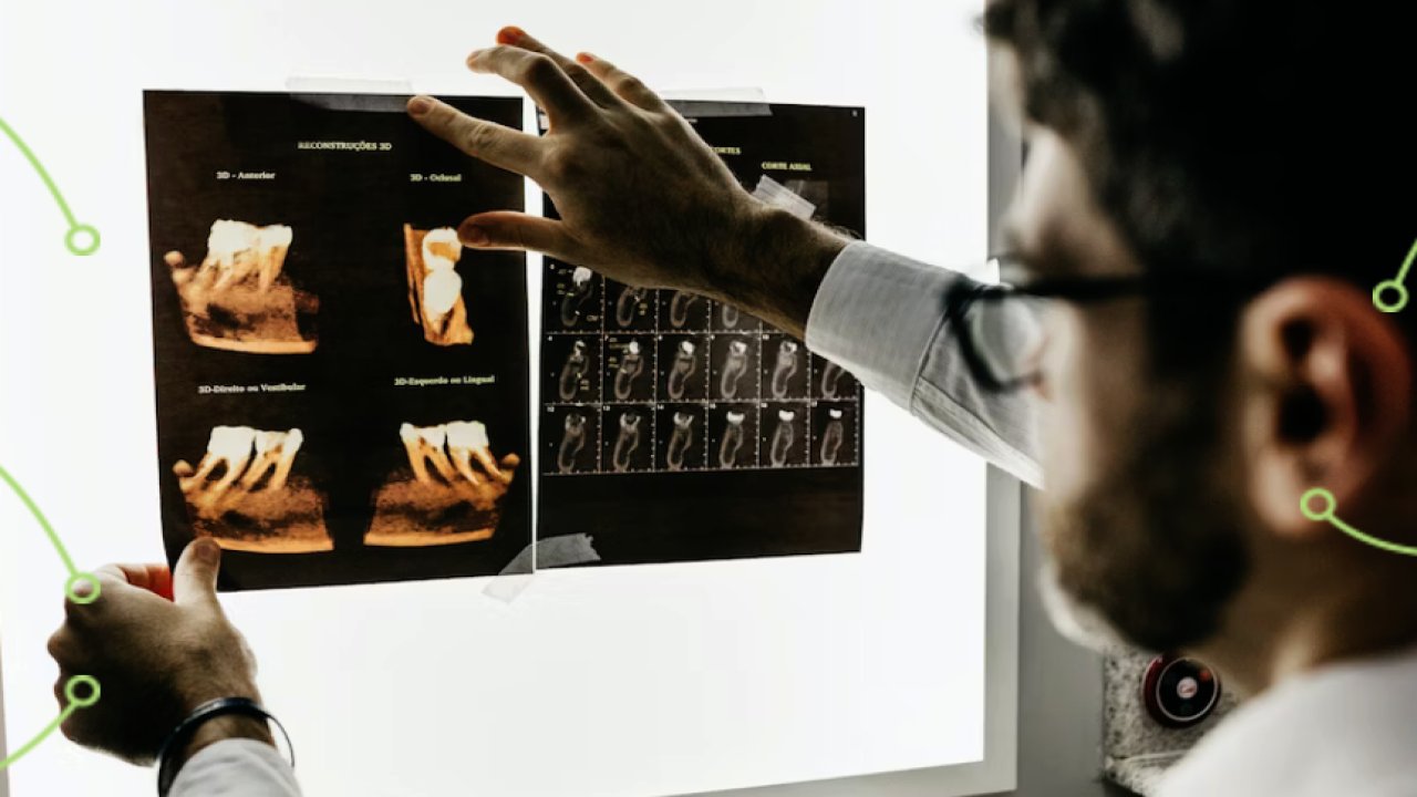 Ülseratif Kolit Hastaları Tedavi İçin Neden Azerbaycan’ı Tercih Ediyor?