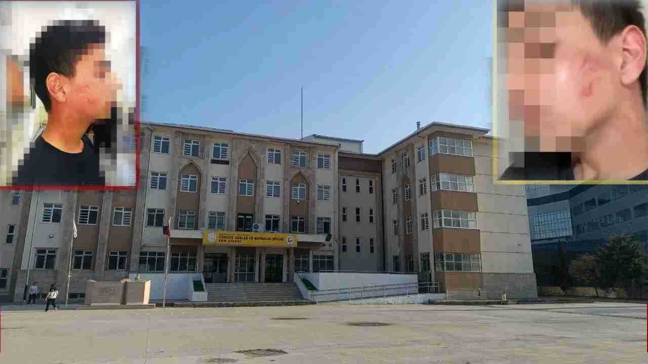 Gaziantep'te TOBB Fen Lisesi'nde Skandal! Öğretmenden Öğrenciye Derste Öldüresiye Dayak!