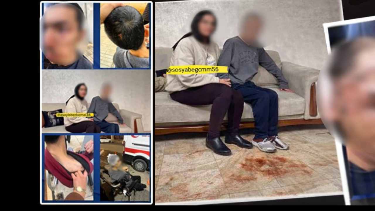 Gaziantepi Sarsan Haber! Engelli Gence Bakımevinde İşkence