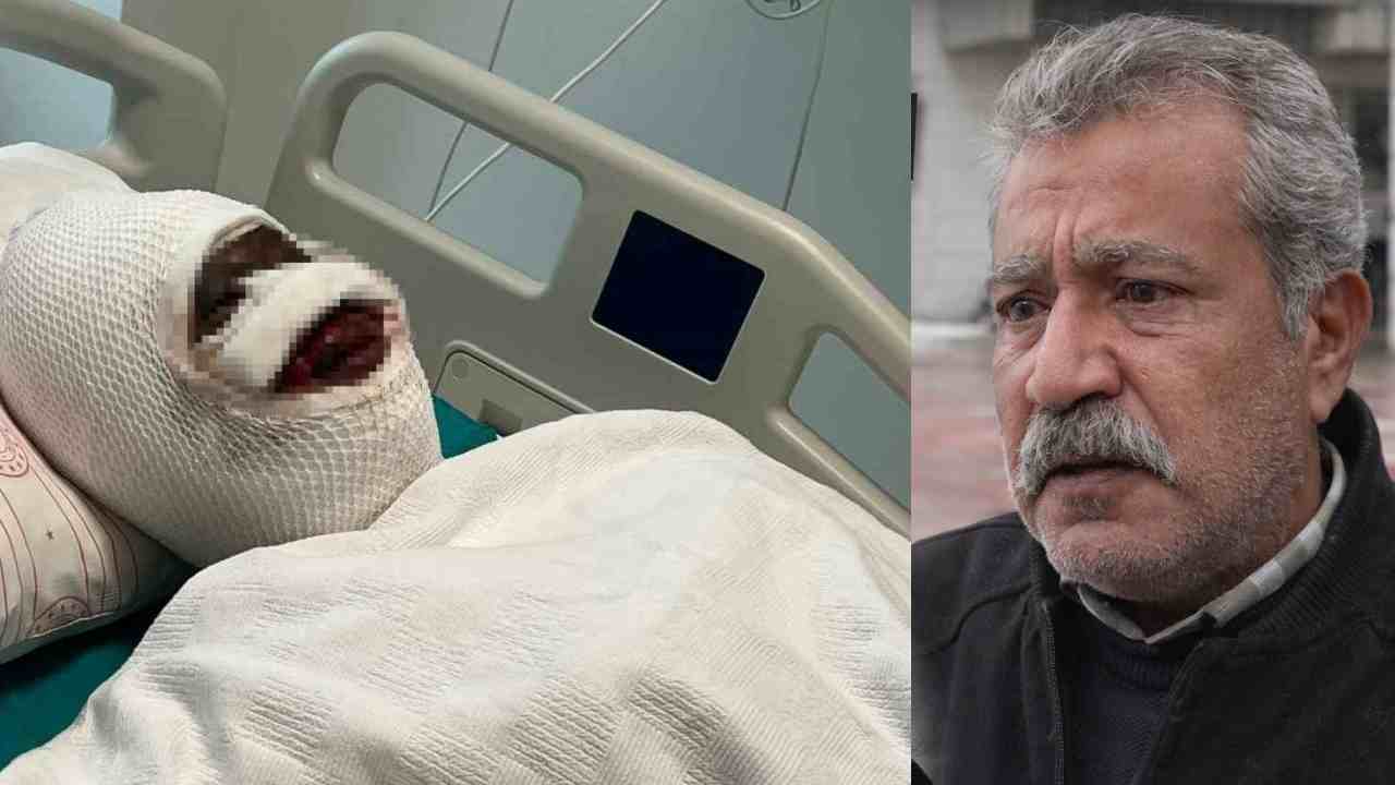 Gaziantep’te Kezzap Dehşeti: Ağır Yaralı Kadın Konuştu, Baba İsyan Etti