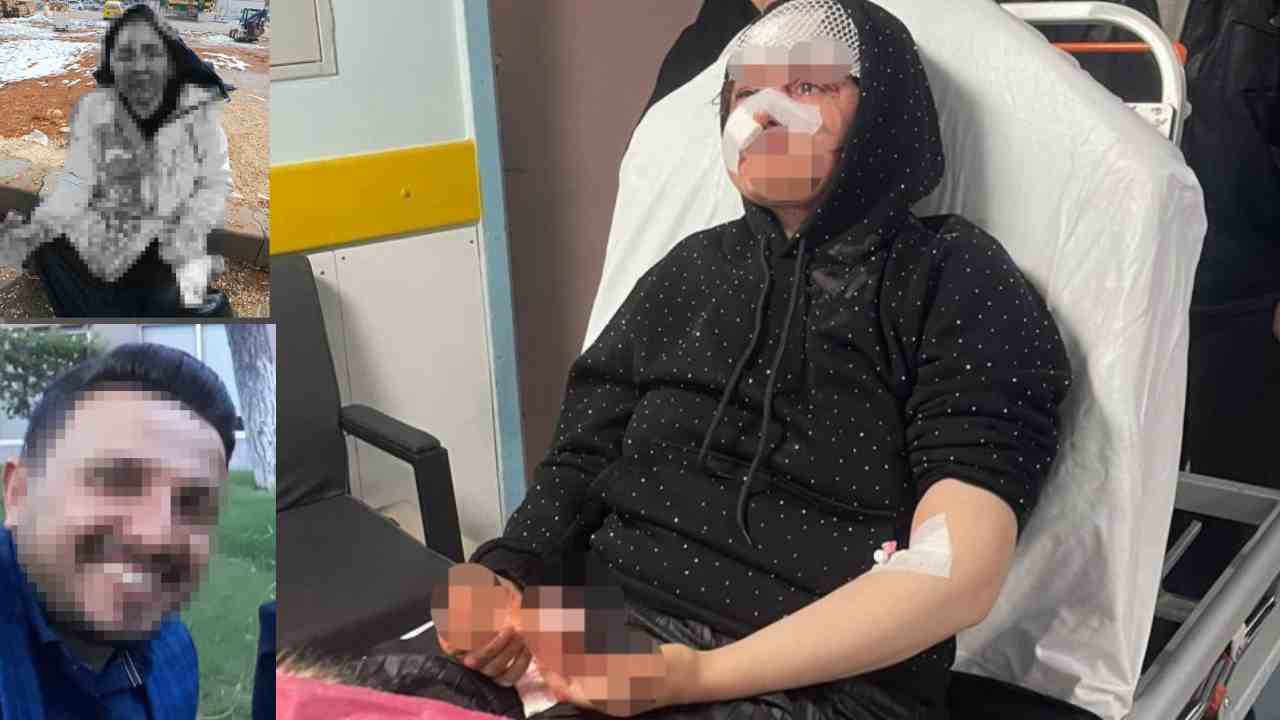 Gaziantep'te Kadıana Şiddet Bitmiyor! Boşanmak İsteyen Karısını Öldüresiye Dövdü!