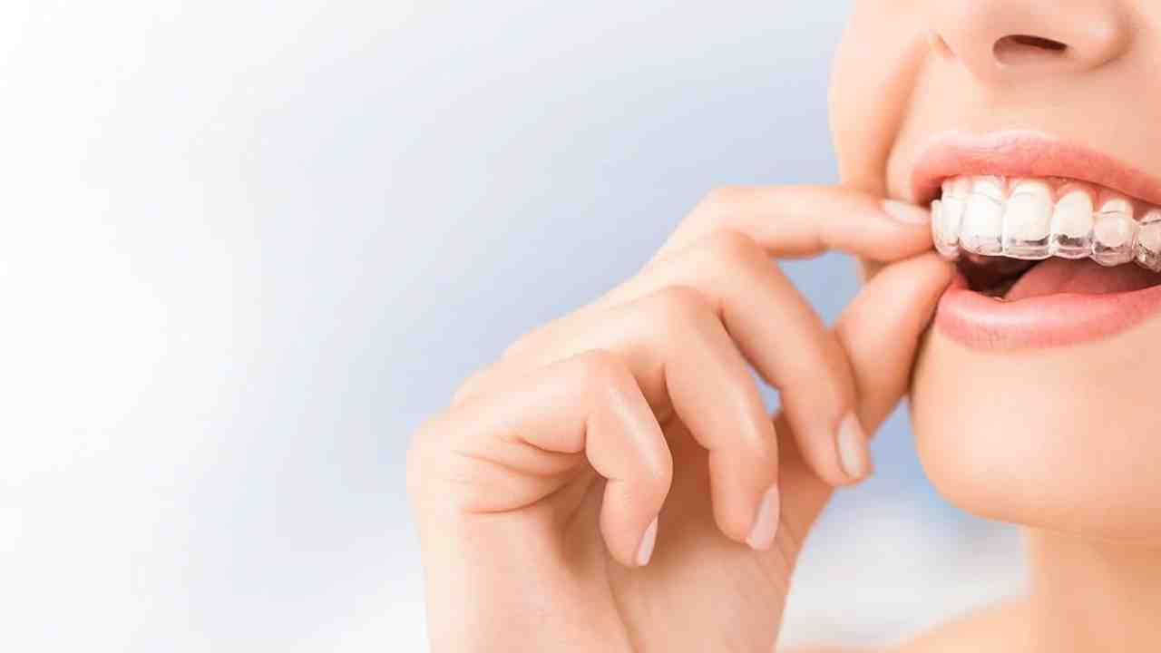 Sağlıklı Dişlere Giden Yolda Hijyenik ve Estetik Çözümler