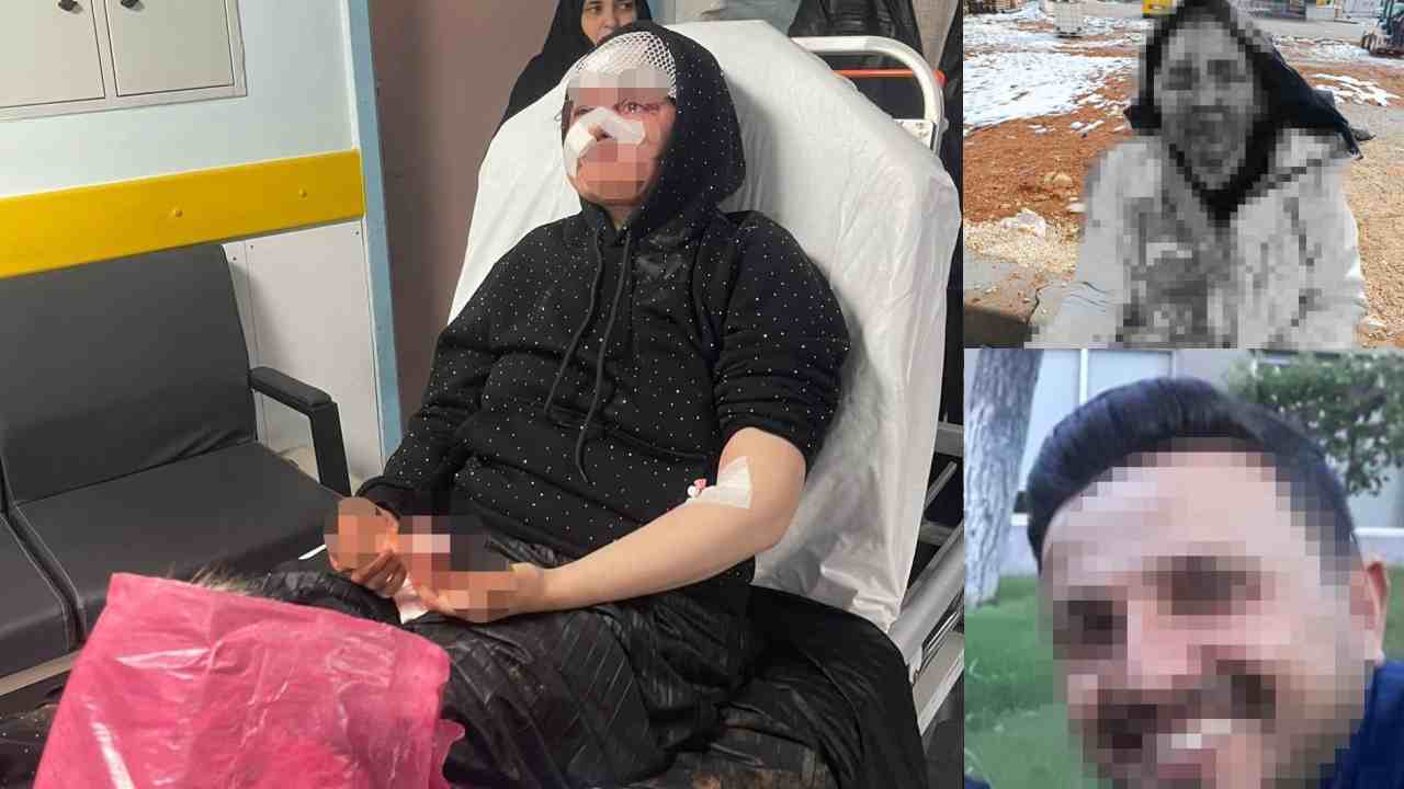 Gaziantep'te boşanmak isteyen karısını öldüresiye darp eden koca tutuklandı