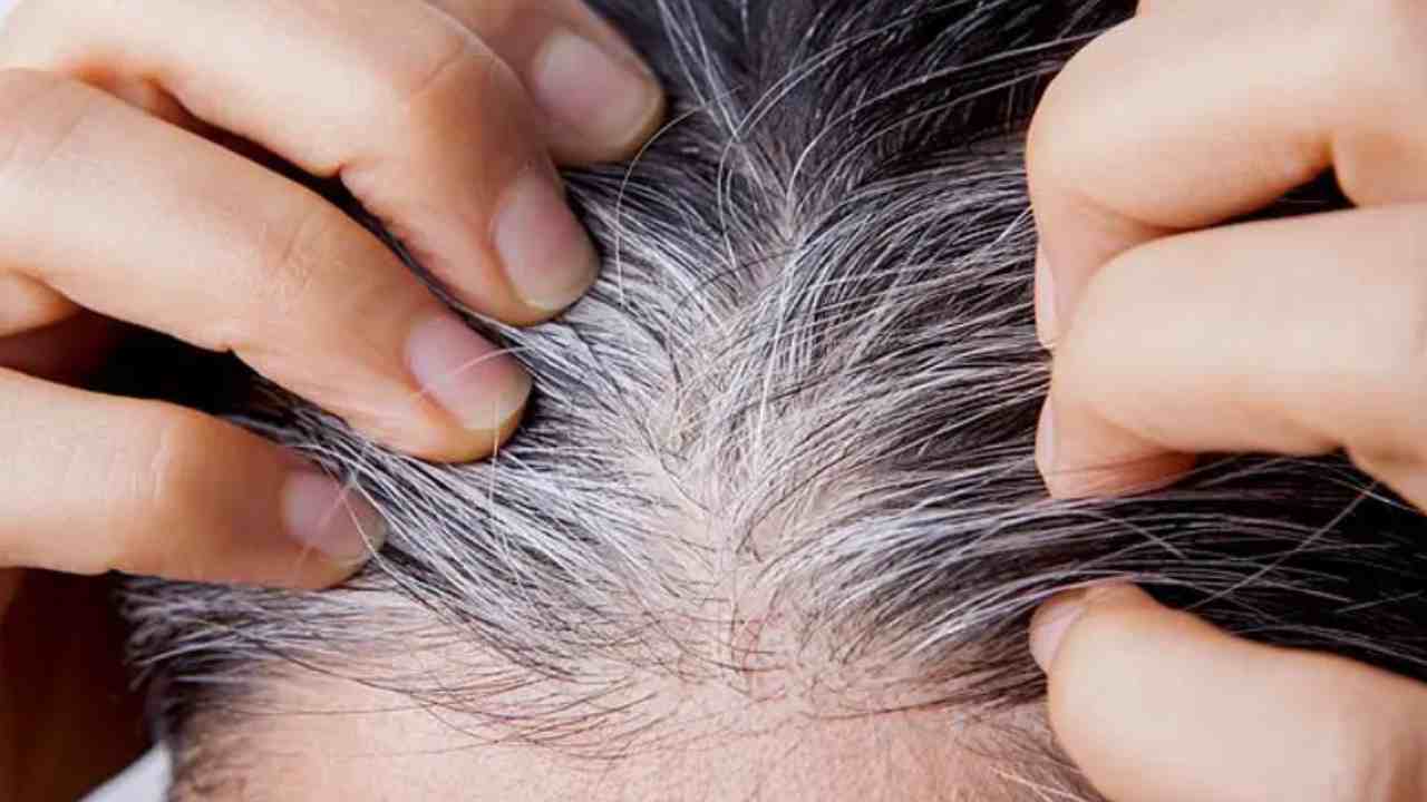 Saç Boyasını Çöpe Atın! Beyaz Saçları Siyaha Döndüren Yöntem