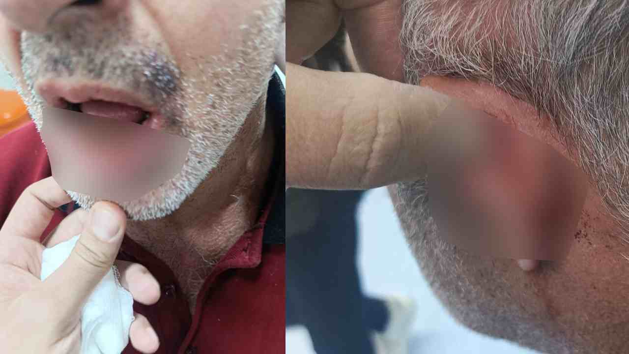 Şehitkamil Devlet Hastanesi’nde Skandal: "Maaşını Ben Veriyorum" Deyip Darp Ettiler