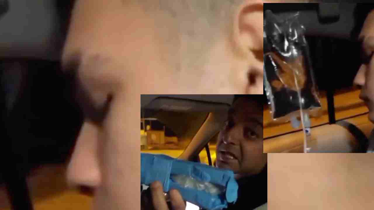 Gaziantep Bu Videoyu Konuşuyor... Parmağını Kaybetti