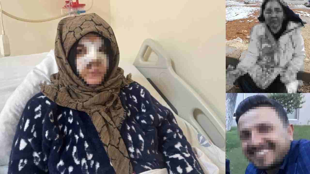 Gaziantep’te eşinin yüzünü taşla ezip darbeden sanık ağır cezada yargılanacak