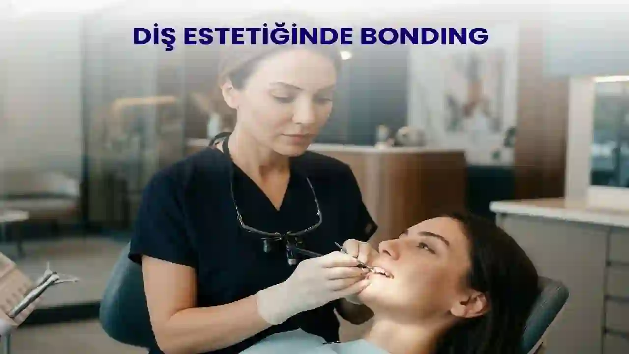 Diş Estetiğinde Hızlı ve Ekonomik Çözüm: Bonding Uygulaması Nedir?