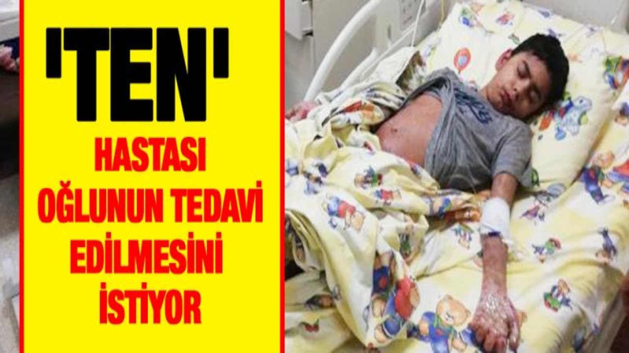 'TEN' hastası oğlunun tedavi edilmesini istiyor