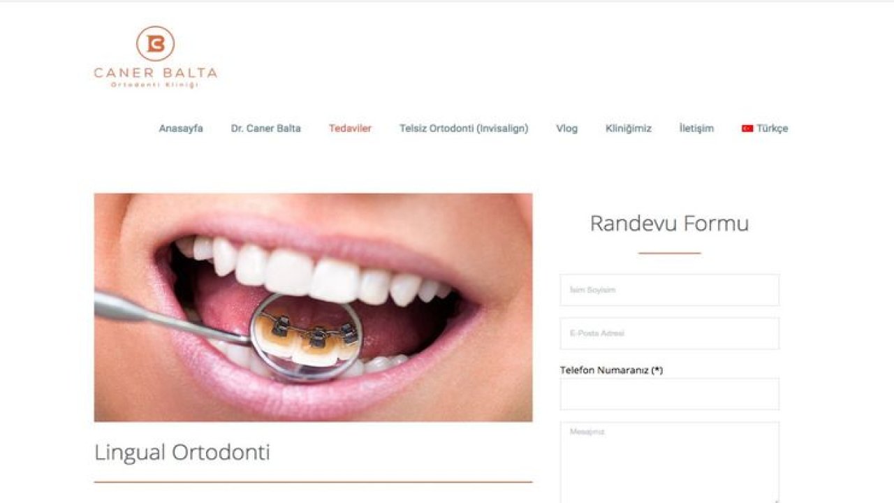 Lingual Ortodonti Nedir?