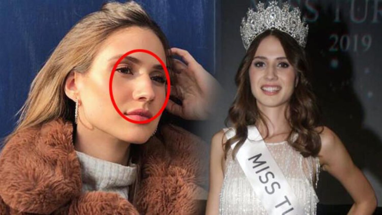 Yakayı gözlükle ele verdi! Reynmen ile Simay Rasimoğlu aşk mı yaşıyor?