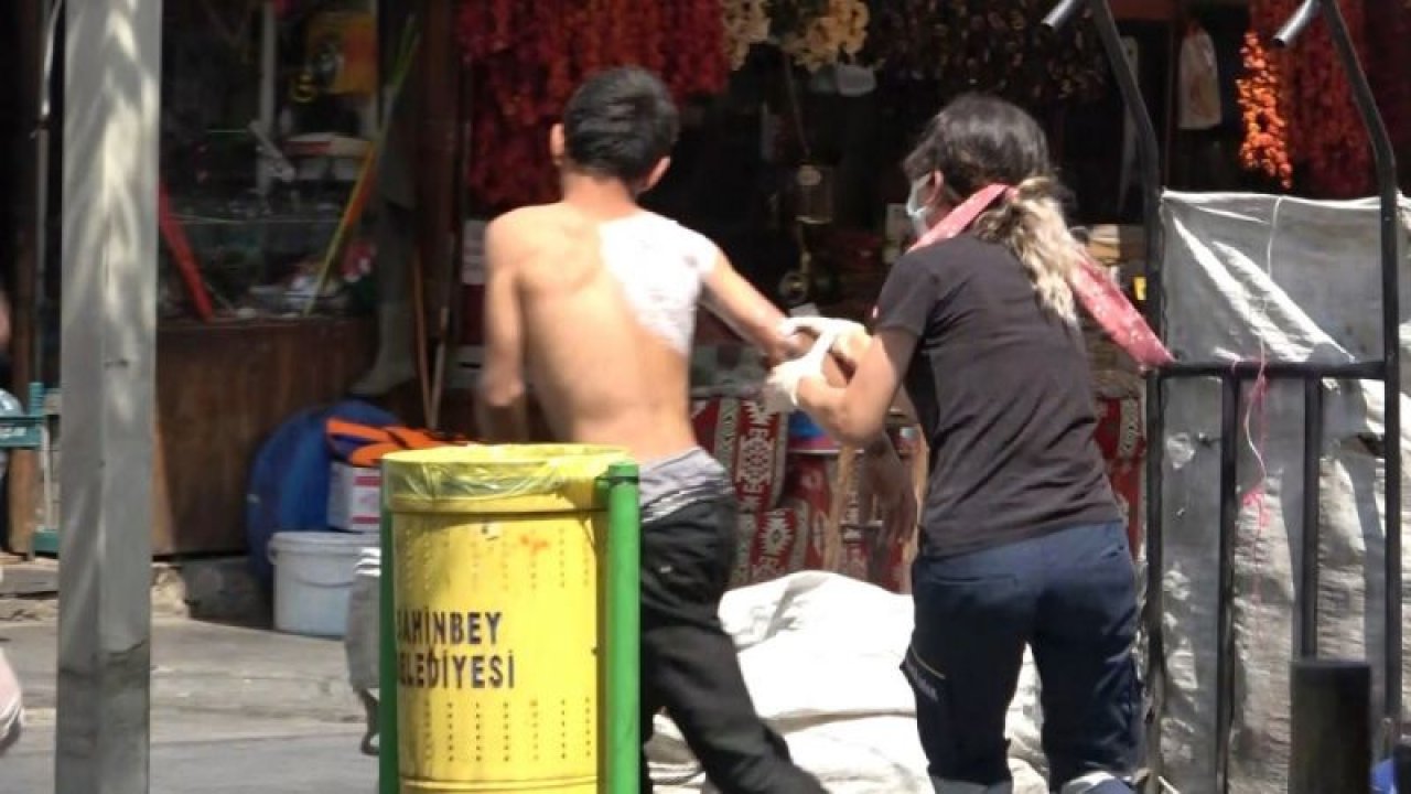 Video Haber...Gaziantep'te İlginç Olay…Üzerine sıcak çay dökülen çocuk ambulanstan kaçtı