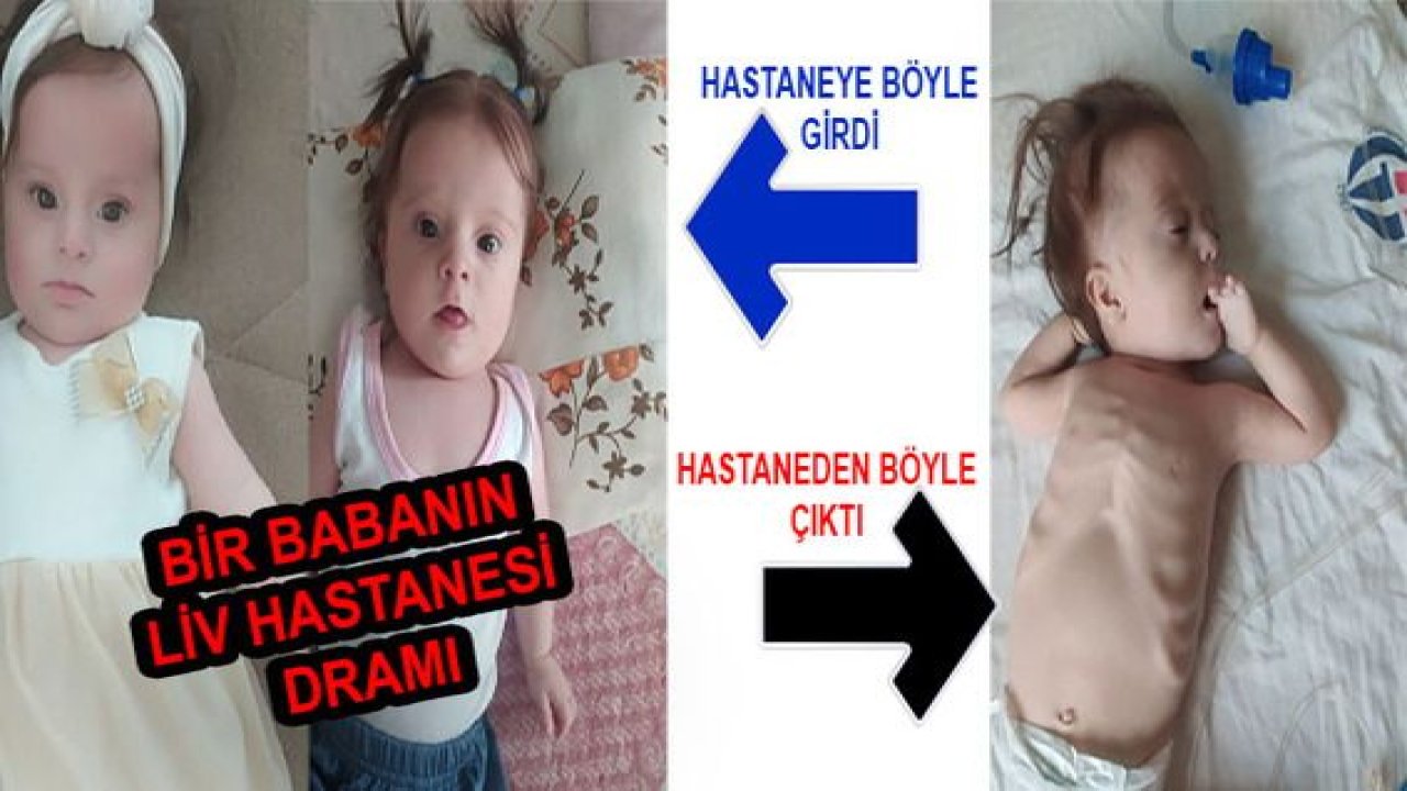 Son Dakika: Gaziantep'te Bir Babanın Liv Hastanesi Dramı