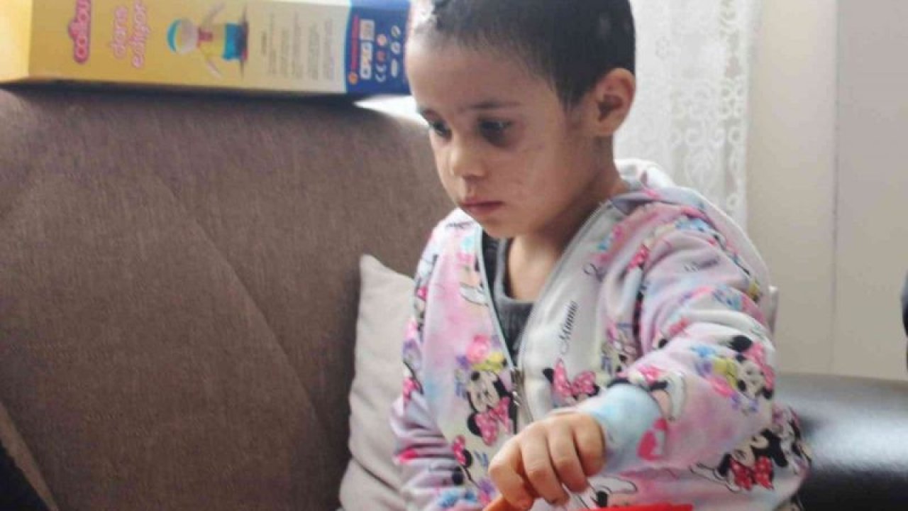 Son Dakika...Gaziantep'te pitbull saldırısına uğrayan minik Asiye evinde ilk kez görüntülendi