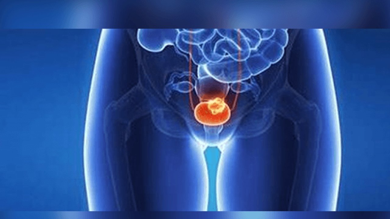 En Sık Ölüme Neden Olan Hastalıklar Arasında Bulunuyor ve Çok Fazla Yanlış Bilgi İçeriyor! Uzman İsim Açıkladı: Bunlara Gerek Yok…