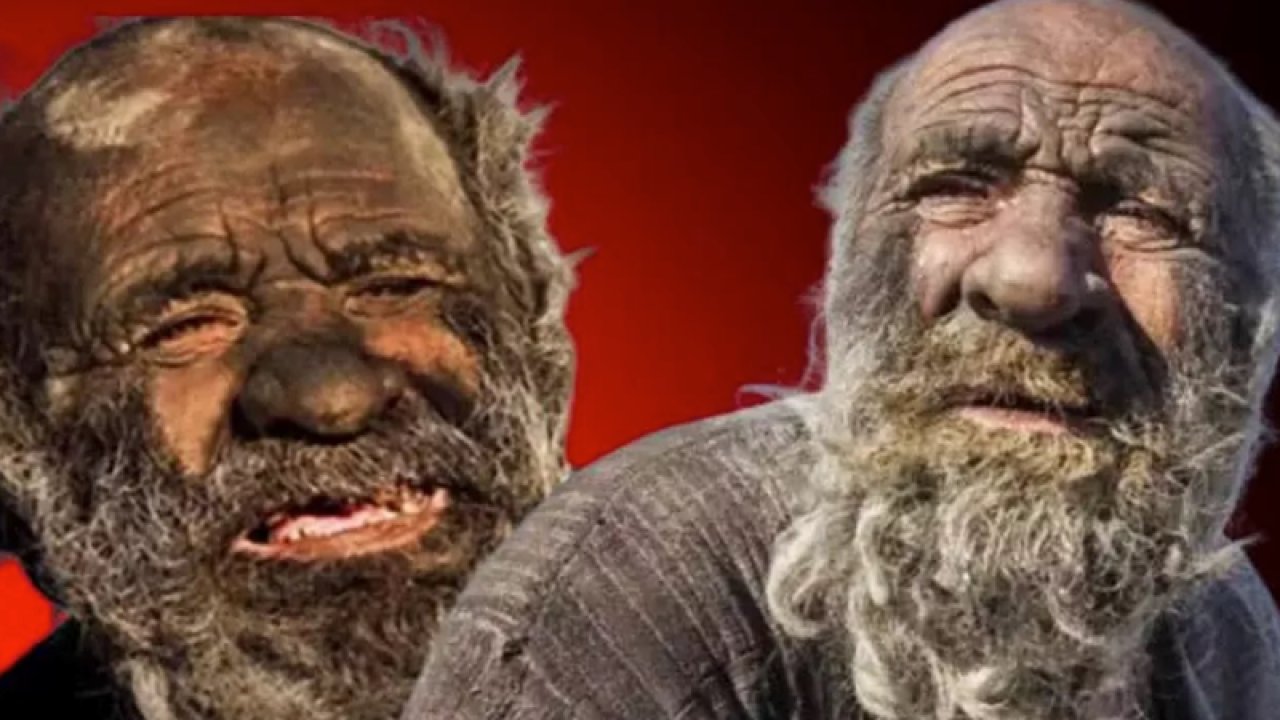 İran’da 50 yılı aşkın süredir banyo yapmayan Amou Haji ‘Dünyanın en kirli adamı, Banyo Yaptı Bir Ay Sonra Hayatını Kaybetti’