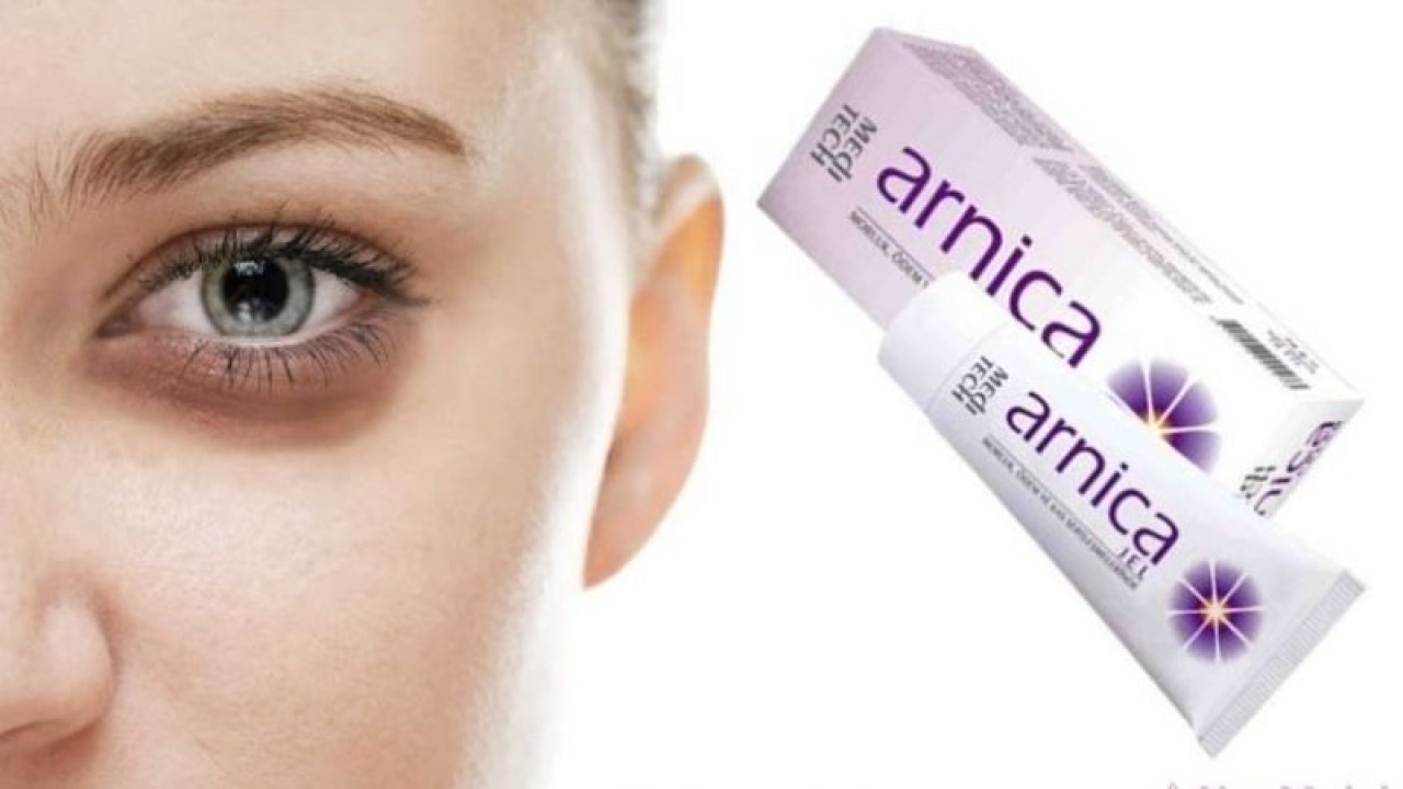 Arnica Krem Ne İşe Yarar, Ne İçin Kullanılır, Fiyatı Ne Kadar?
