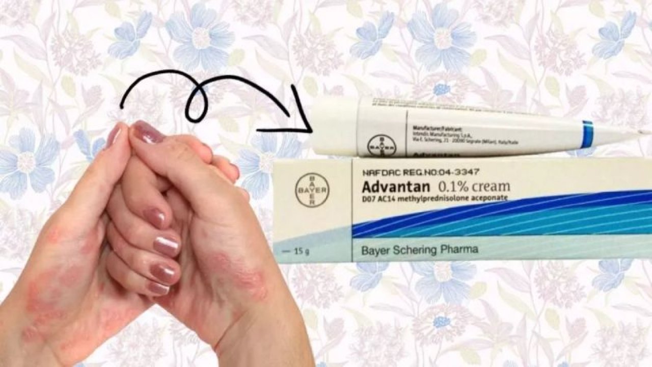 Advantan Krem Ne İşe Yarar, Ne İçin Kullanılır, Fiyatı Ne Kadar?