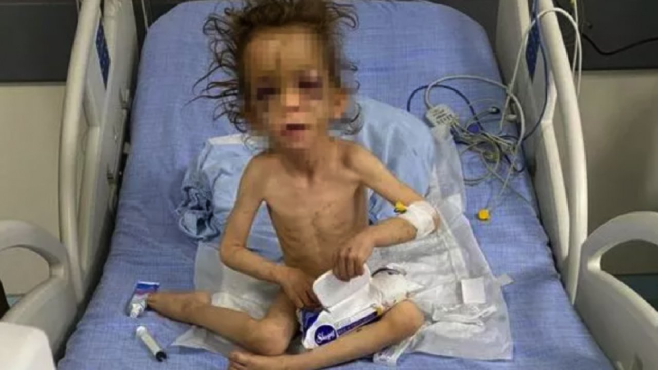 İşte Detaylar.... Gaziantep ve Türkiye Anne Vahşetini Konuşuyor! Gaziantep’te anne, 5 yaşındaki çocuğuna günlerce işkence ederek aç bıraktı... Video HABER