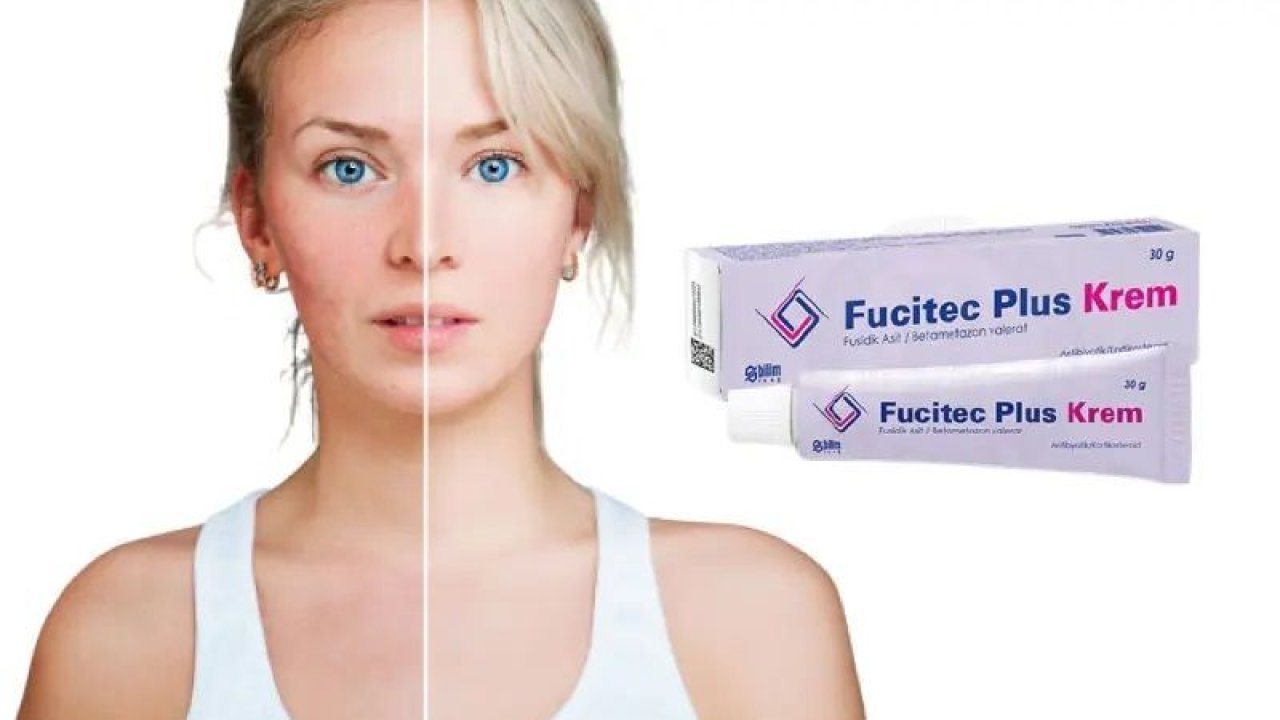 Fucitec Krem Ne İşe Yarar, Ne İçin Kullanılır, Fiyatı Ne Kadar?