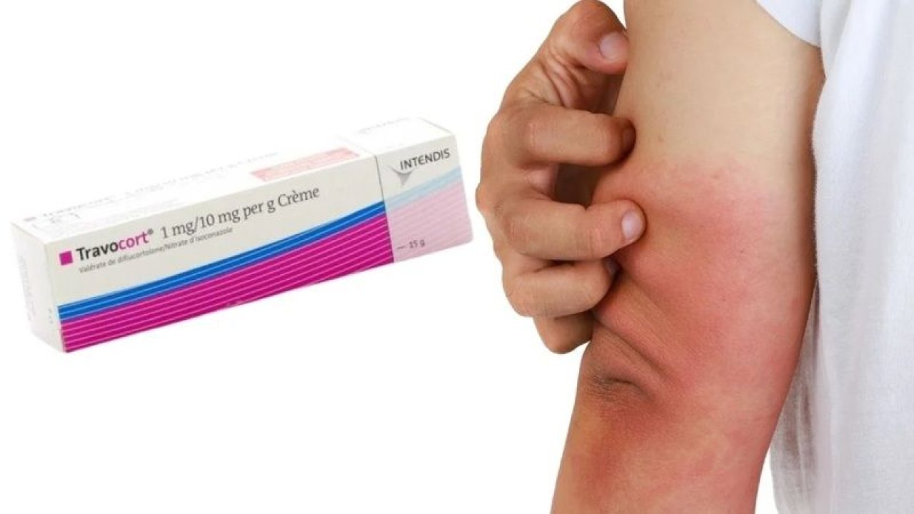 Tracovort Krem Ne İşe Yarar, Ne İçin Kullanılır, Fiyatı Ne Kadar?