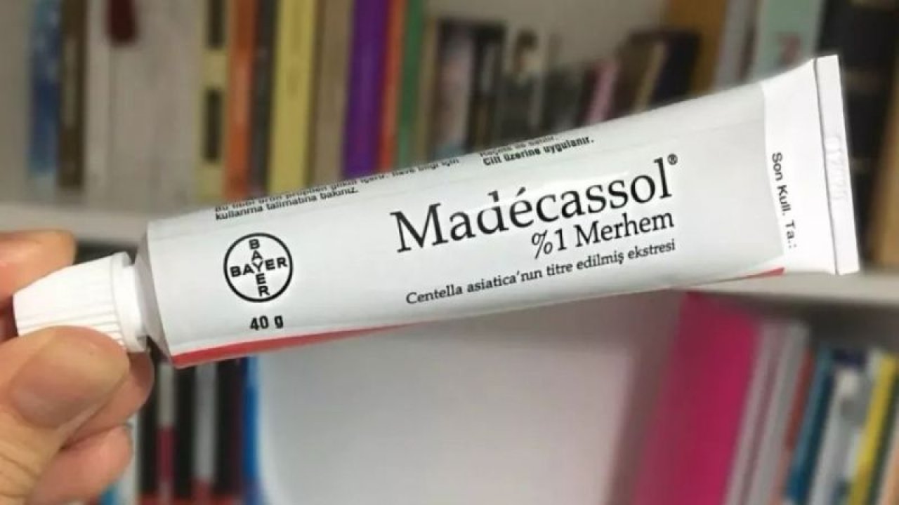 Madecassol Krem Ne İşe Yarar, Ne İçin Kullanılır, Fiyatı Ne Kadar?