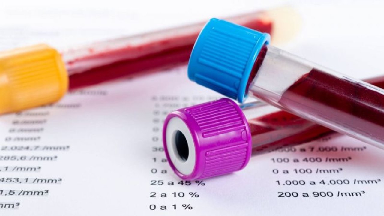 Kan Tahlilinde Hangi Değer Kanseri Gösterir?