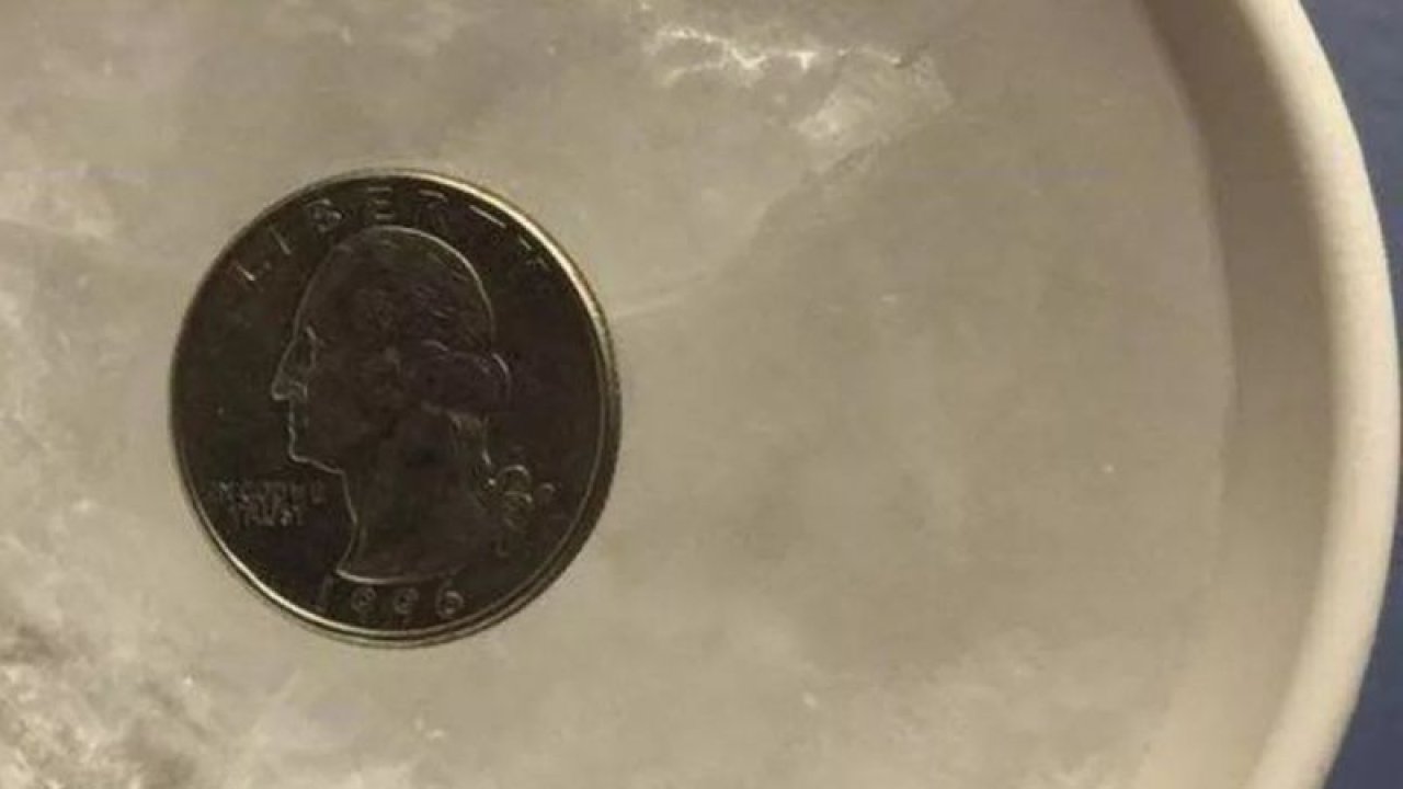 Meğer Parayı Buzdolabına Koyunca! Hastalıktan Kurtulmak İçin Bozuk Para Kullanımı Yaygınlaştı!...